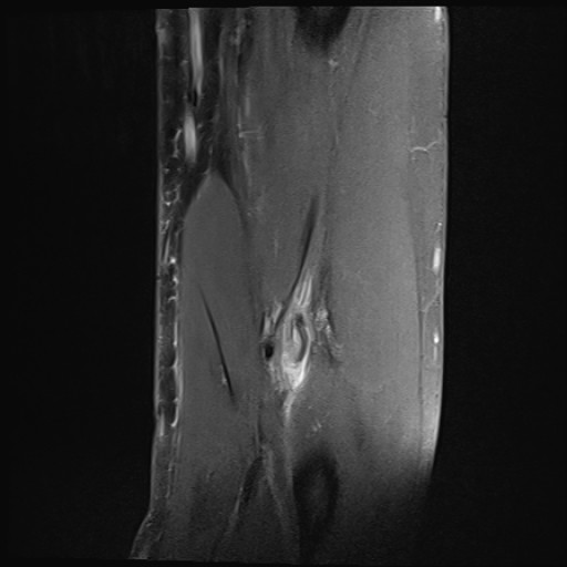 Click on the Serie image to view the images of Wieszt, Gnter